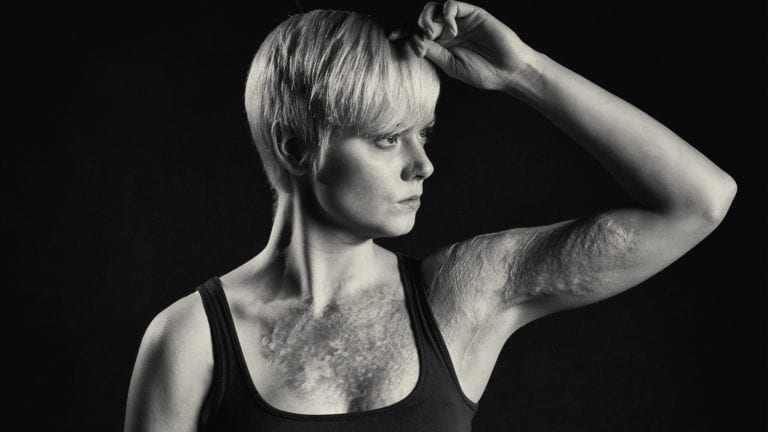 Photographing Marks of Pride and Beauty